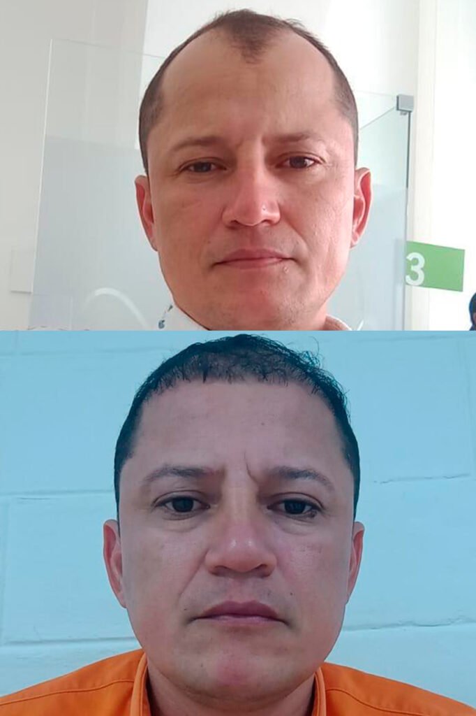 Trasplante-capilar-Sr-vega